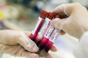 Blood Check Exhibits Promise for Alzheimer’s Prognosis