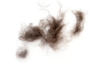 Docs Pulled a 2-Pound Hairball From a Girl’s Abdomen